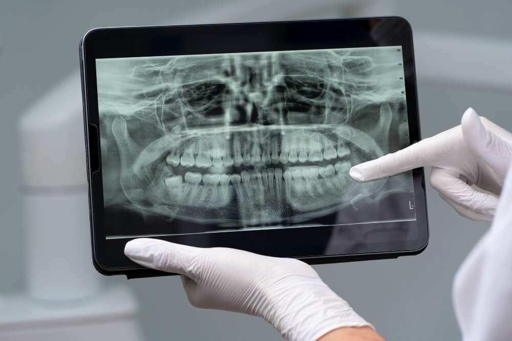 cirugía maxilofacial