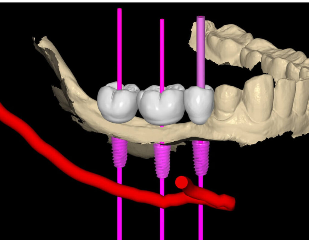 explorando el mundo digital de la odontología