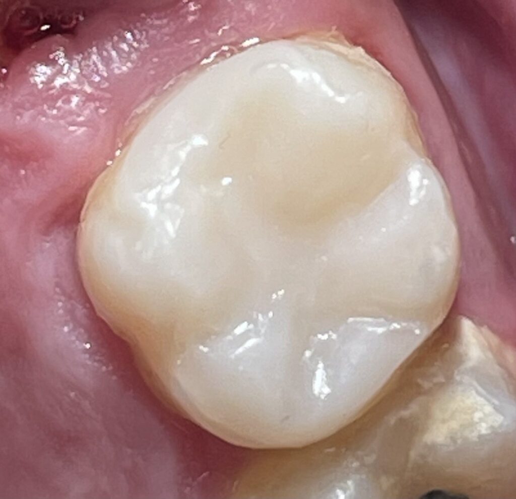 la biomimetica dental