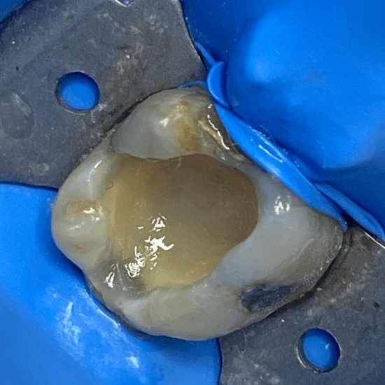 la biomimetica dental