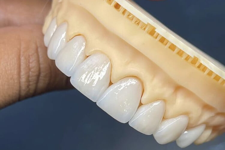 prótesis dental