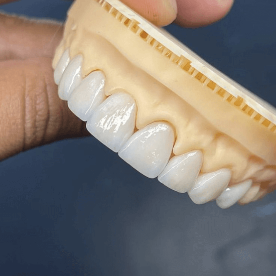 tu prótesis dental es más que una herramienta es tu sonrisa, tu confianza y tu calidad de vida