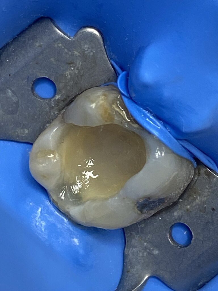 Biomimética Dental