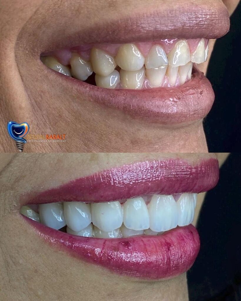 prótesis dental especialidad