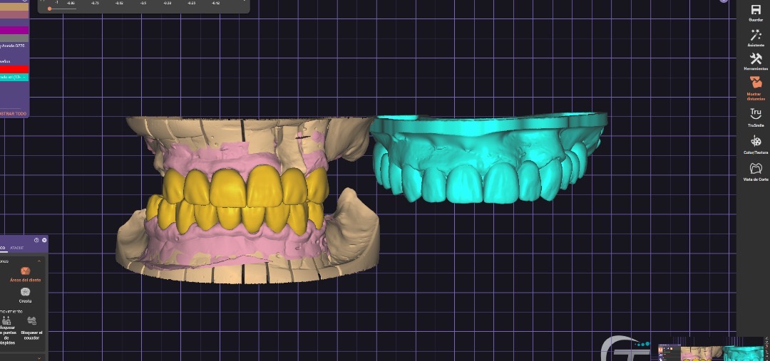 Odontología digital
