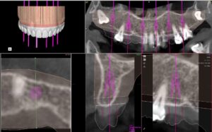 Odontología digital