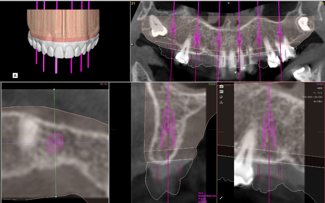 Odontología digital