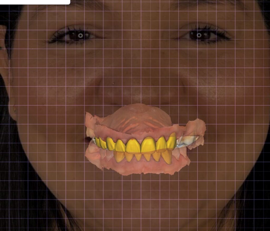 Odontología digital en caracas