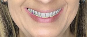 Odontología digital