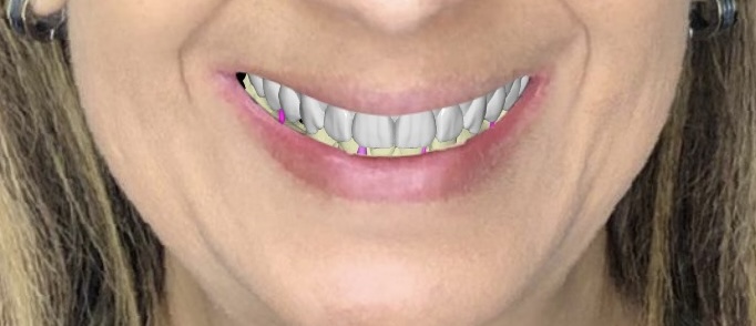 Odontología digital