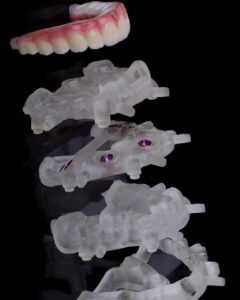 Odontología digital