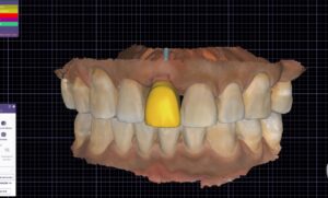 Odontología digital