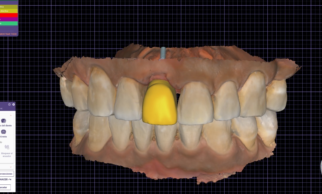 Odontología digital